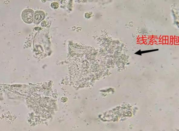 1749518387476807.png db443ab4a82fc1ca268f291aecd4e9c9.png