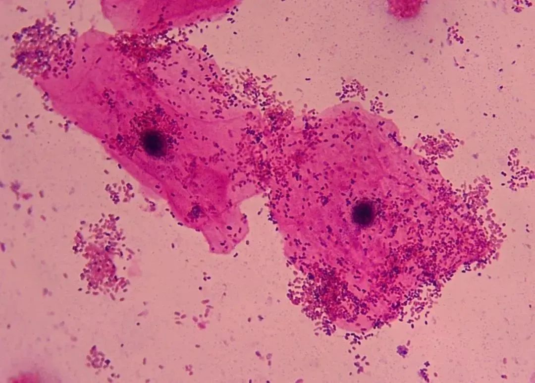 1749518415978767.jpg 6da4cdf25d4962fe16d60cdf716d24e6.jpg